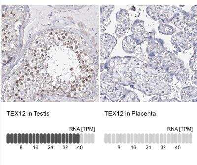 Immunohistochemistry-Paraffin: TEX12 Antibody [NBP1-90989] - Analysis in human testis and placenta tissues using antibody. Corresponding TEX12 RNA-seq data are presented for the same tissues.