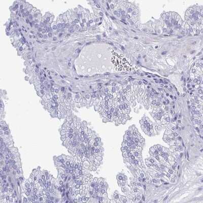 Immunohistochemistry-Paraffin: TEX12 Antibody [NBP2-32656] - Staining of human prostate shows low expression as expected.
