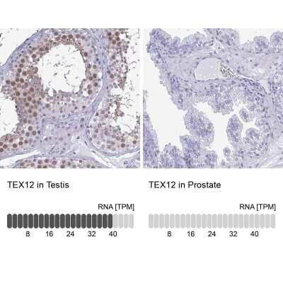 <b>Orthogonal Strategies Validation. </b>Immunohistochemistry-Paraffin: TEX12 Antibody [NBP2-32656] - Staining in human testis and prostate tissues using anti-TEX12 antibody. Corresponding TEX12 RNA-seq data are presented for the same tissues.