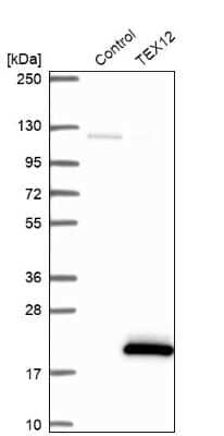 Western Blot: TEX12 Antibody [NBP2-32656] - Analysis in control (vector only transfected HEK293T lysate) and TEX12 over-expression lysate (Co-expressed with a C-terminal myc-DDK tag (3.1 kDa) in mammalian HEK293T cells).