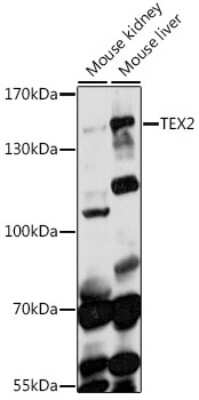 Western Blot: TEX2 Antibody [NBP2-93786] - Analysis of extracts of various cell lines, using TEX2 at 1:1000 dilution. Secondary antibody: HRP Goat Anti-Rabbit IgG (H+L) at 1:10000 dilution. Lysates/proteins: 25ug per lane. Blocking buffer: 3% nonfat dry milk in TBST. Detection: ECL Basic Kit . Exposure time: 90s.