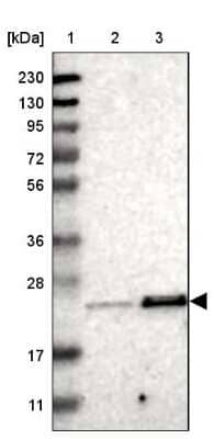 Western Blot: TEX261 Antibody [NBP1-81126] - Lane 1: Marker [kDa] 230, 130, 95, 72, 56, 36, 28, 17, 11Lane 2: Human cell line RT-4Lane 3: Human cell line U-251MG sp
