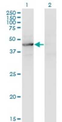 Western Blot: TEX28 Antibody (1A8) [H00001527-M05] - Analysis of TEX28 expression in transfected 293T cell line by TEX28 monoclonal antibody (M05), clone 1A8. Lane 1: TEX28 transfected lysate (Predicted MW: 46.1 KDa). Lane 2: Non-transfected lysate.