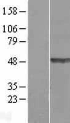 Western Blot: TEX28 Overexpression Lysate (Adult Normal) [NBL1-16825] Left-Empty vector transfected control cell lysate (HEK293 cell lysate); Right -Over-expression Lysate for TEX28.