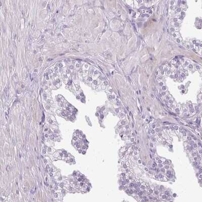 Immunohistochemistry-Paraffin: TEX30 Antibody [NBP2-30640] - Staining of human prostate shows low expression as expected.