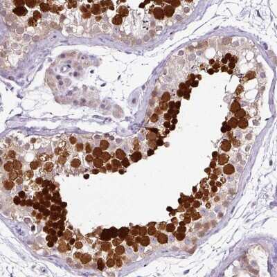 Immunohistochemistry-Paraffin: TEX30 Antibody [NBP2-30640] - Staining of human testis shows high expression.