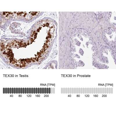 Immunohistochemistry-Paraffin: TEX30 Antibody [NBP2-30640] - Staining in human testis and prostate tissues using anti-TEX30 antibody. Corresponding TEX30 RNA-seq data are presented for the same tissues.