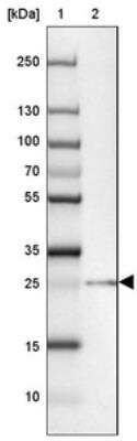 Western Blot: TEX30 Antibody [NBP2-30640] - Lane 1: Marker  [kDa] 250, 130, 100, 70, 55, 35, 25, 15, 10.  Lane 2: MOLT-4