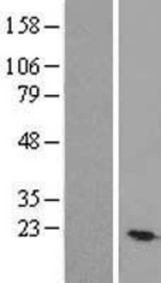 Western Blot: TEX30 Overexpression Lysate (Adult Normal) [NBL1-08160] Left-Empty vector transfected control cell lysate (HEK293 cell lysate); Right -Over-expression Lysate for TEX30.