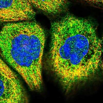 Immunocytochemistry/Immunofluorescence: TEX9 Antibody [NBP1-86249] - Staining of human cell line A-431 shows localization to cytosol. Antibody staining is shown in green.