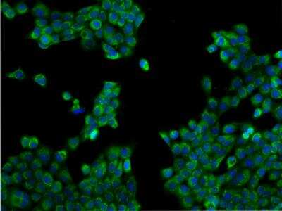 Immunocytochemistry/Immunofluorescence: TEX9 Antibody [NBP3-06298] - Immunofluorescence staining of TEX9 in A431 cells. Cells were fixed with 4% PFA, permeabilzed with 0.1% Triton X-100 in PBS,blocked with 10% serum, and incubated with rabbit anti-Human TEX9 polyclonal antibody (dilution ratio 1:200) at 4 degrees celsius overnight. Then cells were stained with the Alexa Fluor (TM) 488-conjugated Goat Anti-rabbit IgG secondary antibody (green) and counterstained with DAPI (blue).Positive staining was localized to Cytoplasm.