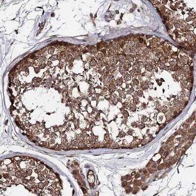 Immunohistochemistry-Paraffin: TEX9 Antibody [NBP1-86249] - Staining of human testis shows strong cytoplasmic positivity in cells in seminiferus ducts.