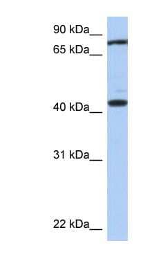 Western Blot: TEX9 Antibody [NBP1-56553] - Human Brain lysate, concentration 0.2-1 ug/ml.