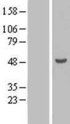 Western Blot: TEX9 Overexpression Lysate (Adult Normal) [NBL1-16826] Left-Empty vector transfected control cell lysate (HEK293 cell lysate); Right -Over-expression Lysate for TEX9.