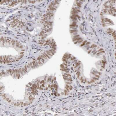 Immunohistochemistry-Paraffin: TFAP4 Antibody [NBP1-89060] - Staining of human Fallopian tube shows moderate nuclear positivity in glandular cells.