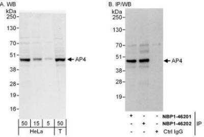 Western Blot: TFAP4 Antibody [NBP1-46202] - Whole cell lysate from HeLa (5, 15 and 50 mcg for WB; 1 mg for IP, 20% of IP loaded) and 293T (T; 50 mcg) cells.  Affinity purified rabbit anti-AP4 antibody used for WB at 0.04 mcg/ml (A) and 0.4 mcg/ml (B) and used for IP at 3 mcg/mg lysate.  AP4 was also immunoprecipitated by rabbit anti-AP4 antibody NBP1-46201, which recognizes an upstream epitope.