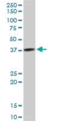 Western Blot: TFB2M Antibody [H00064216-B01P] - Analysis of TFB2M expression in A-431.
