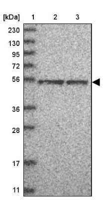 Western Blot: TFCP2L1 Antibody [NBP1-85441] - Lane 1: Marker  [kDa] 230, 130, 95, 72, 56, 36, 28, 17, 11.  Lane 2: Human cell line RT-4.  Lane 3: Human cell line U-251MG sp