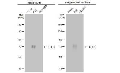 Western Blot: TFEB Antibody (HL1065) [NBP3-13706] - Various whole cell extracts (30 ug) were separated by 7.5% SDS-PAGE, and the membranes were blotted with TFEB antibody [HL1065] (NBP3-13706) diluted at 1:5000 and competitor's antibody (# Highly Cited Antibody) diluted at 1:1000. The HRP-conjugated anti-rabbit IgG antibody (NBP2-19301) was used to detect the primary antibody.