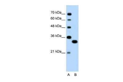 Western Blot: TFEC Antibody [NBP3-10931] - Western blot analysis of TFEC in Jurkat cell lysate as a positive control. Antibody dilution at 0.2-1 ug/ml