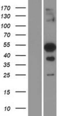 Western Blot: TFEC Overexpression Lysate (Adult Normal) [NBP2-08676] Left-Empty vector transfected control cell lysate (HEK293 cell lysate); Right -Over-expression Lysate for TFEC.