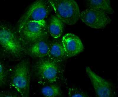 Immunocytochemistry/Immunofluorescence: TFF1/pS2 Antibody (JM37-86) [NBP2-75681] - Staining Estrogen Inducible Protein pS2 in A549 cells (green). The nuclear counter stain is DAPI (blue). Cells were fixed in paraformaldehyde, permeabilised with 0.25% Triton X100/PBS.