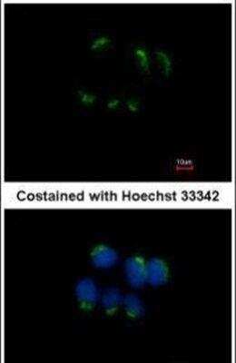 Immunofluorescence: TFF1/pS2 Antibody (pS2.1) [NB120-3079] - Analysis of Trefoil factor 1 in methanol-fixed MCF-7 cells using a Trefoil factor 1 polyclonal antibody.