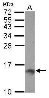 Western Blot: TFF1/pS2 Antibody (pS2.1) [NB120-3079] - Analysis of Trefoil factor 1 using 30 ug of MCF-7 lysate. Samples were loaded onto a 15% SDS-PAGE gel and probed with a Trefoil factor 1 polyclonal antibody.