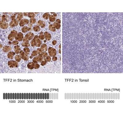 Immunohistochemistry-Paraffin: TFF2 Antibody [NBP2-34032] - Analysis in human stomach and tonsil tissues using NBP2-34032 antibody. Corresponding TFF2 RNA-seq data are presented for the same tissues.