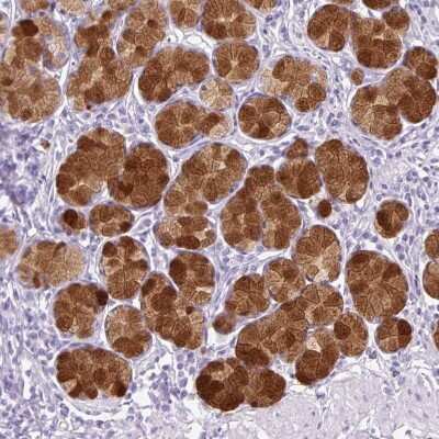 <b>Orthogonal Strategies Validation. </b>Immunohistochemistry-Paraffin: TFF2 Antibody [NBP2-34032] - Staining of human Stomach shows strong membranous and cytoplasmic positivity in glandular cells.