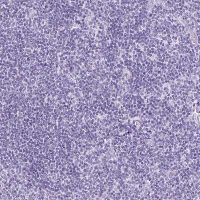 Immunohistochemistry-Paraffin: TFF2 Antibody [NBP2-34032] - Staining of human Tonsil shows no positivity in non-germinal center cells as expected.