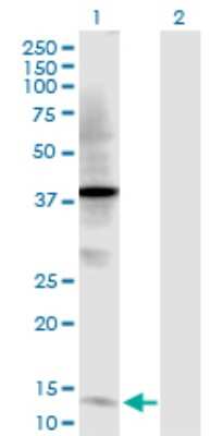 Western Blot: TFF2 Antibody [H00007032-D01P] - Analysis of TFF2 expression in transfected 293T cell line by TFF2 polyclonal antibody.Lane 1: TFF2 transfected lysate(14.30 KDa).Lane 2: Non-transfected lysate.
