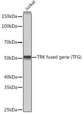 Western Blot: TFG Antibody (0V5P10) [NBP3-15484] - Western blot analysis of extracts of Jurkat cells, using TFG (TFG) Rabbit mAb (NBP3-15484) at 1:3000 dilution. Secondary antibody: HRP Goat Anti-Rabbit IgG (H+L) at 1:10000 dilution. Lysates/proteins: 25ug per lane. Blocking buffer: 3% nonfat dry milk in TBST. Detection: ECL Basic Kit. Exposure time: 1s.