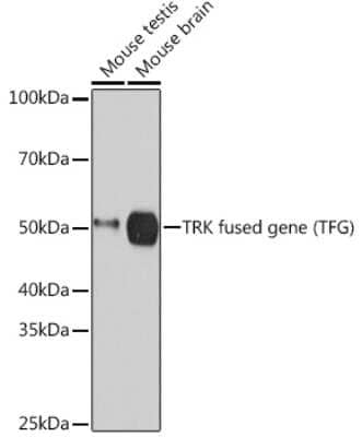 Western Blot: TFG Antibody (0V5P10) [NBP3-15484] - Western blot analysis of extracts of various cell lines, using TFG (TFG) Rabbit mAb (NBP3-15484) at 1:3000 dilution. Secondary antibody: HRP Goat Anti-Rabbit IgG (H+L) at 1:10000 dilution. Lysates/proteins: 25ug per lane. Blocking buffer: 3% nonfat dry milk in TBST. Detection: ECL Basic Kit. Exposure time: 60s.