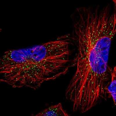 Immunocytochemistry/Immunofluorescence: TFG Antibody [NBP1-81957] - Staining of human cell line U-251 MG shows positivity in vesicles.