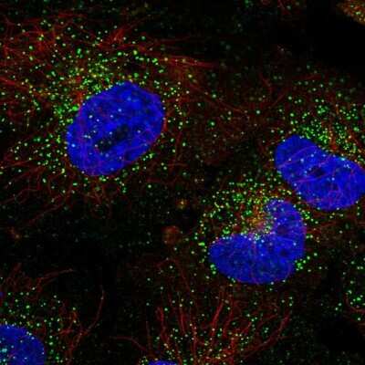 Immunocytochemistry/Immunofluorescence: TFG Antibody [NBP2-56681] - Staining of human cell line U-251 MG shows localization to vesicles.