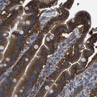 Immunohistochemistry-Paraffin: TFG Antibody [NBP1-81957] - Staining of human duodenum shows strong cytoplasmic positivity in glandular cells.