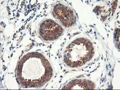 Immunohistochemistry: TFG Antibody (OTI2C3) - Azide and BSA Free [NBP2-74491] - Staining of paraffin-embedded Human breast tissue using anti-TFG mouse monoclonal antibody.