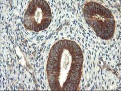 Immunohistochemistry: TFG Antibody (OTI2C3) - Azide and BSA Free [NBP2-74491] - Staining of paraffin-embedded Human endometrium tissue using anti-TFG mouse monoclonal antibody.