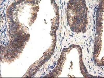 Immunohistochemistry: TFG Antibody (OTI2C3) - Azide and BSA Free [NBP2-74491] - Staining of paraffin-embedded Human prostate tissue using anti-TFG mouse monoclonal antibody.