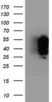 Western Blot: TFG Antibody (OTI2C3) - Azide and BSA Free [NBP2-74491] - HEK293T cells were transfected with the pCMV6-ENTRY control (Left lane) or pCMV6-ENTRY TFG (Right lane) cDNA for 48 hrs and lysed. Equivalent amounts of cell lysates (5 ug per lane) were separated by SDS-PAGE and immunoblotted with anti-TFG.