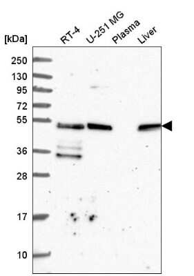 Western Blot: TFG Antibody [NBP2-56681] - Analysis in human cell line RT-4, human cell line U-251 MG, human plasma and human liver tissue.