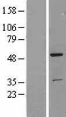 Western Blot: TFG Overexpression Lysate (Adult Normal) [NBL1-16841] Left-Empty vector transfected control cell lysate (HEK293 cell lysate); Right -Over-expression Lysate for TFG.