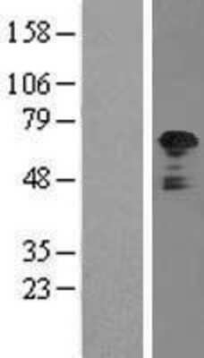 Western Blot: TFG Overexpression Lysate (Adult Normal) [NBL1-16842] - Western Blot experiments.  Left-Control; Right -Over-expression Lysate for TFG