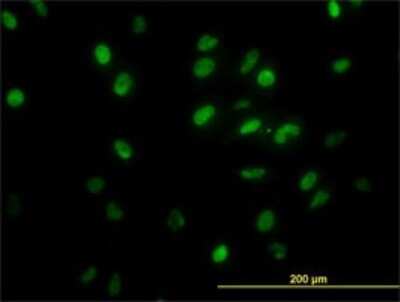 Immunocytochemistry/Immunofluorescence: TFII-I Antibody (2D6) [H00002969-M02] - Analysis of monoclonal antibody to GTF2I on HeLa cell. Antibody concentration 10 ug/ml.