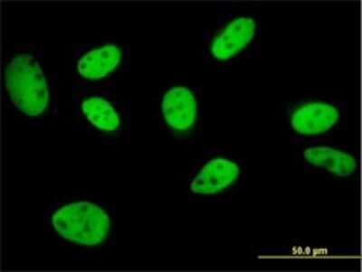 Immunocytochemistry/Immunofluorescence: TFII-I Antibody (3E2) [H00002969-M01] - Analysis of monoclonal antibody to GTF2I on HeLa cell . Antibody concentration 10 ug/ml.