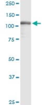 Western Blot: TFII-I Antibody (3E2) [H00002969-M01] - GTF2I monoclonal antibody (M01), clone 3E2. Analysis of GTF2I expression in human colon.