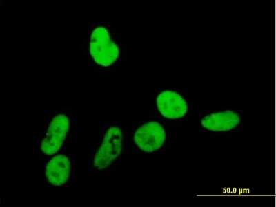 Immunocytochemistry/Immunofluorescence: TFII-I Antibody [H00002969-B01P] - Analysis of purified antibody to GTF2I on HeLa cell. (antibody concentration 10 ug/ml)
