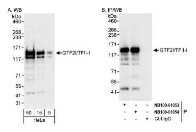 <b>Independent Antibodies Validation. </b>Immunoprecipitation: TFII-I Antibody [NB100-61054] - Detection of human GTF2I/TFII-I by western blot and immunoprecipitation. Samples: Whole cell lysate (5, 15 and 50 ug for WB; 1 mg for IP, 20% of IP loaded) from HeLa cells. Antibodies: Affinity purified rabbit anti-GTF2I/TFII-I antibody NB100-61054 used for WB at 0.04 ug/ml (A) and 1 ug/ml (B) and used for IP at 3 ug/mg lysate. GTF2I/TFII-I was also immunoprecipitated by rabbit anti-GTF2I/TFII-I antibody NB100-61053, which recognizes an upstream epitope. Detection: Chemiluminescence with exposure times of 3 seconds (A) and 1 second (B).