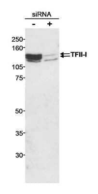 Western Blot: TFII-I Antibody [NB500-156] - Whole cell  lysate (100 ug) from HEK293 cells treated with GTF2I/TFII-I siRNA (+) or untreated (-).  Antibody used at 0.2 ug/ml.